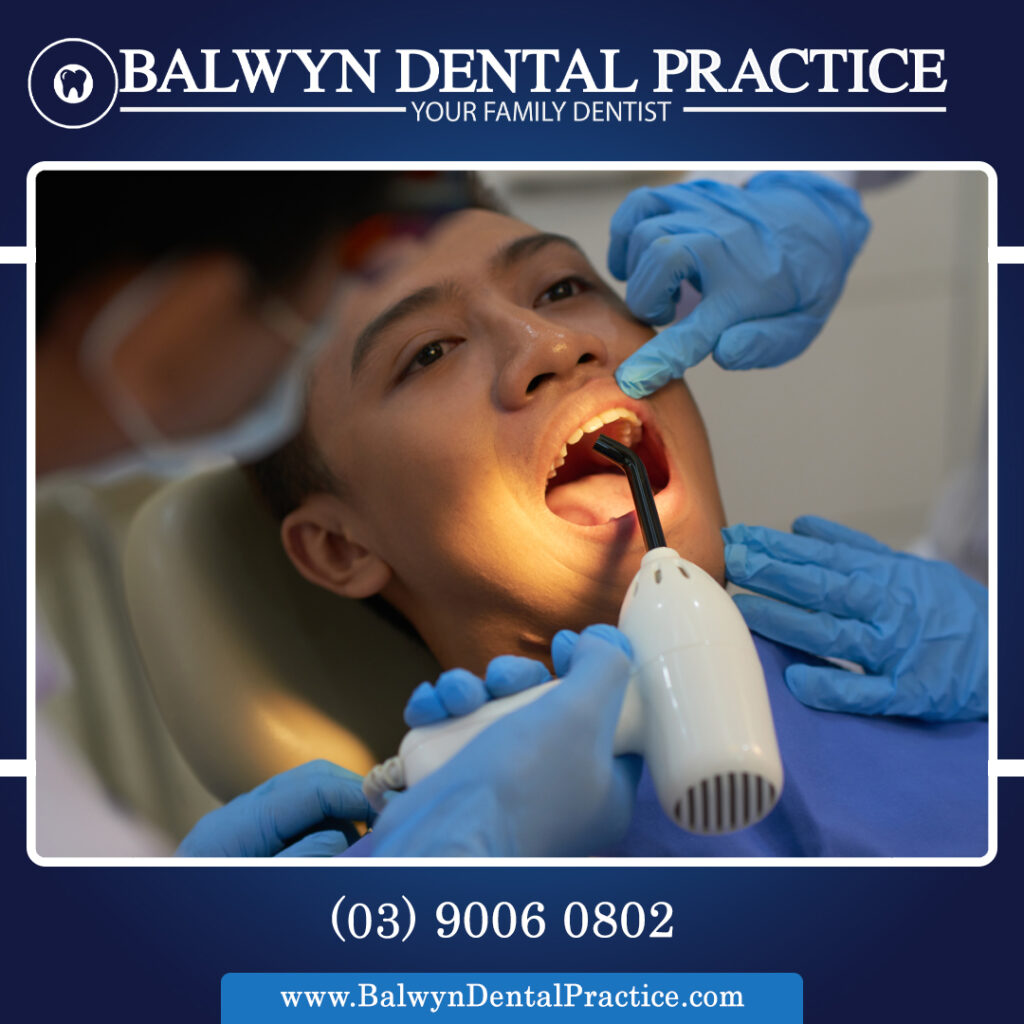 Dental Root Canal
