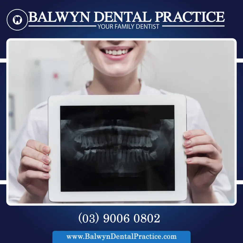 Dental X-Rays.