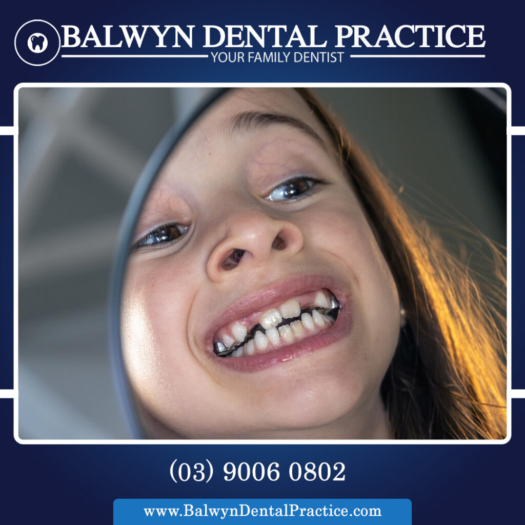 Fixing Teeth Gaps