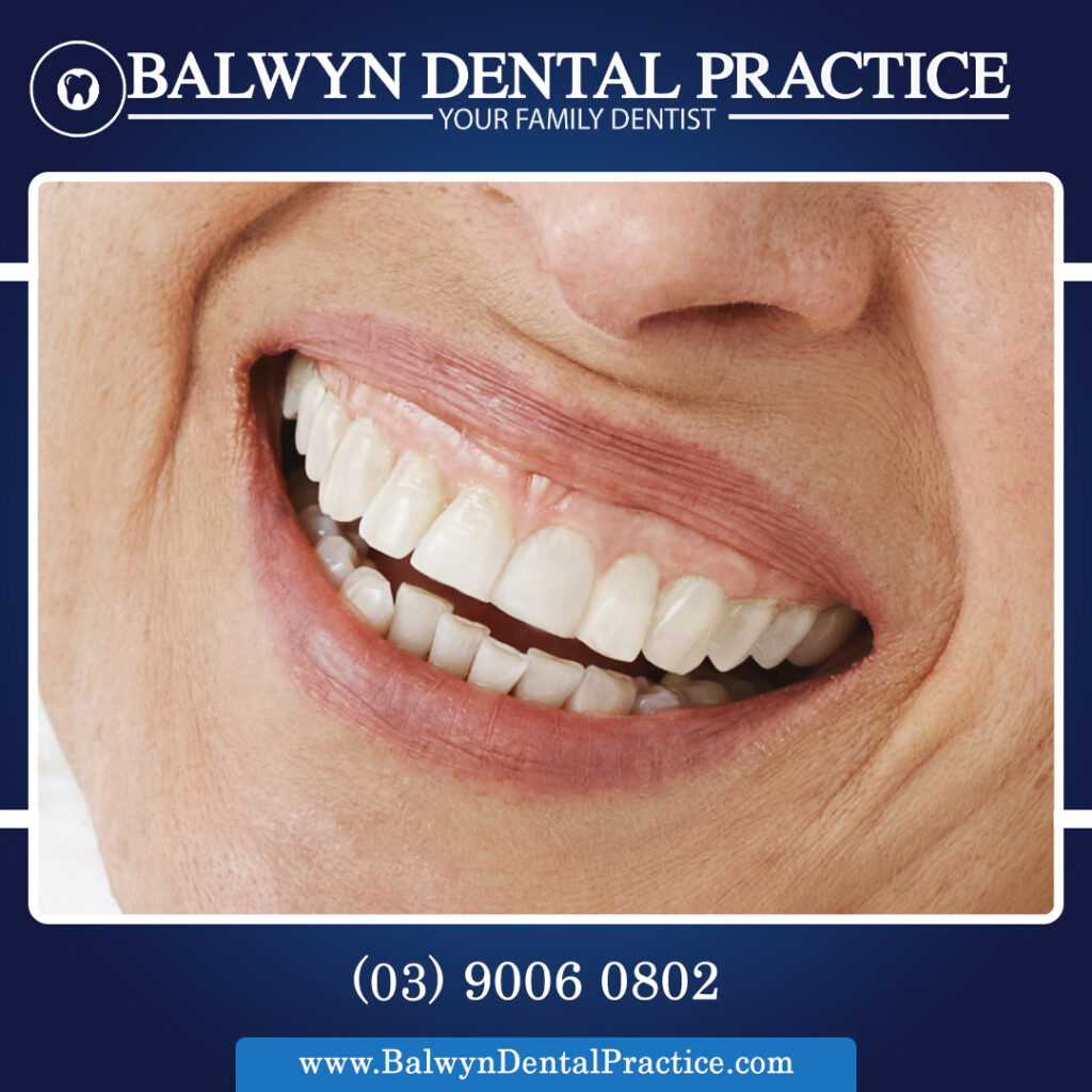 Full Dentures