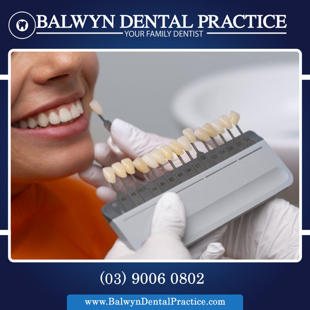 Tooth-Colored Fillings