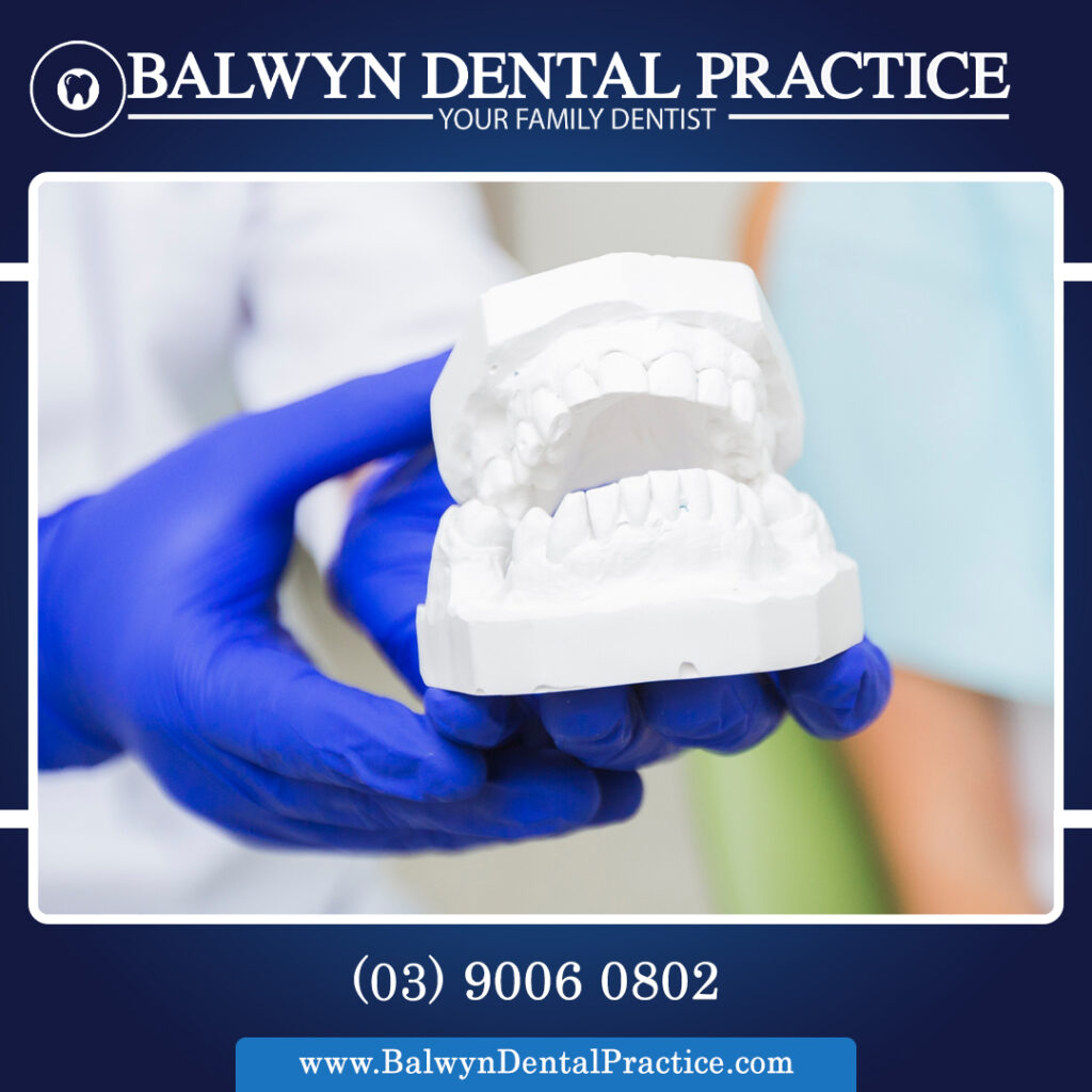 Types of Dental Crowns