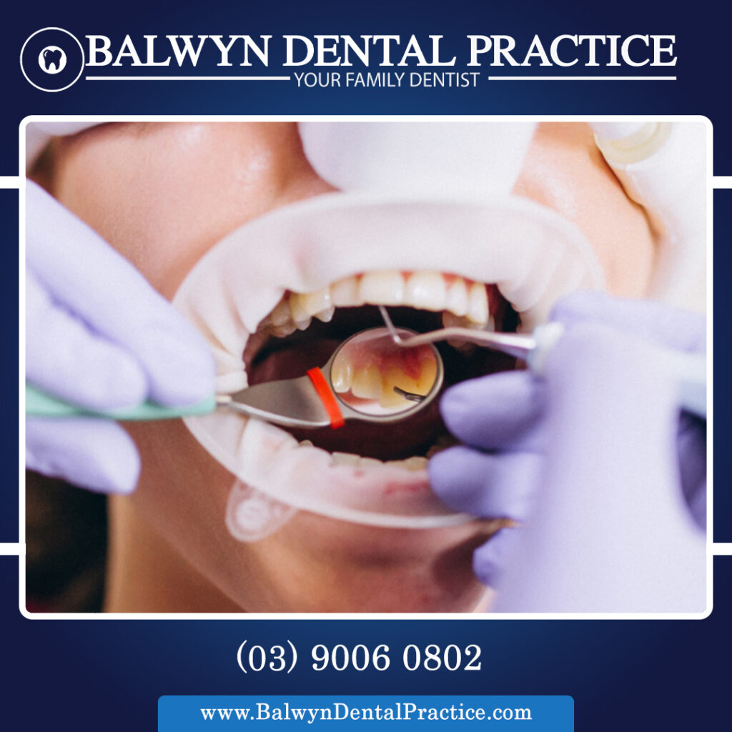 dental Scaling & Cleaning.