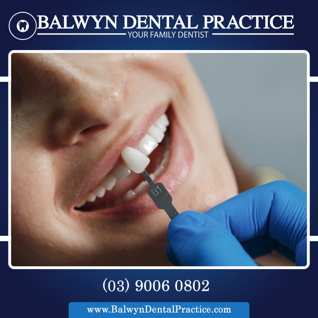 dental composite