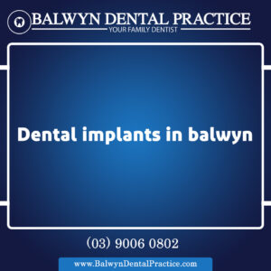 dental implants in balwyn